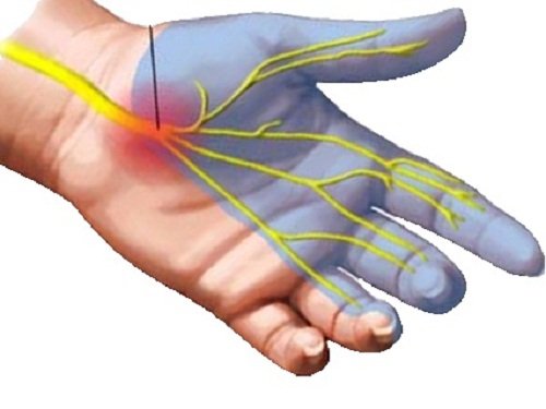 a bal kéz mutatóujja falának ízületi fájdalma